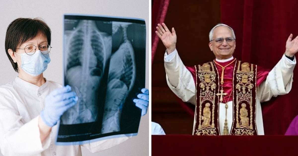 Nódulo pulmonar é sempre câncer? Entenda o caso do papa Leão XIV