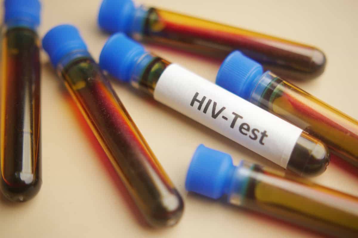 Brasil testa novo tratamento injetável de ação longa para HIV